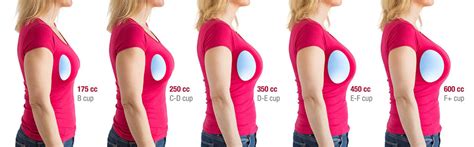 breast expension|Breast Augmentation: What You Should Know .